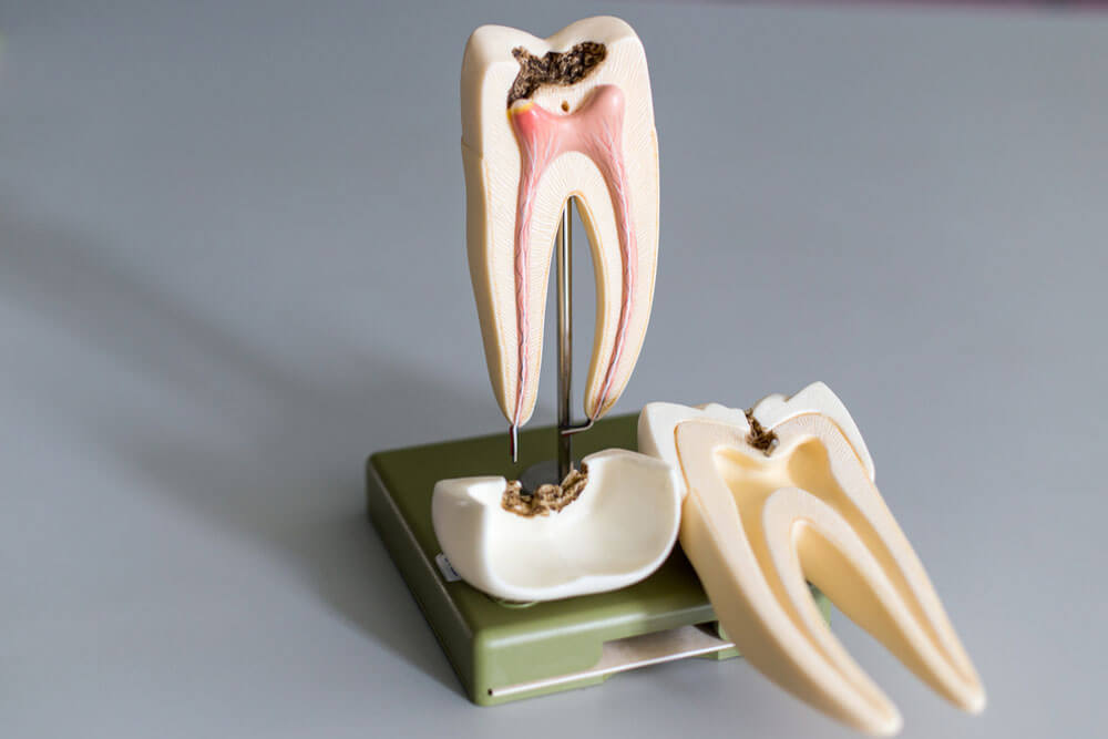 Tooth model for education in laboratory.